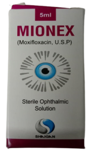 MIONEX